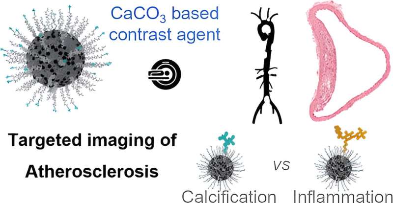 利用超小碳酸钙纳米颗粒提升动脉粥样硬化诊断